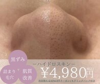 イルナ(ILUNA)