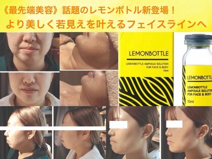 ペリドット(Peridot)の写真