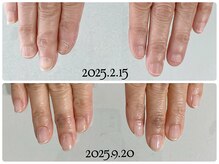 7カ月でここまで改善☆自爪育成で縦長爪を手に入れる。