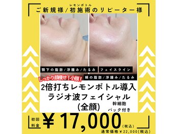 ボーテボナー(Beaute Bonheur)