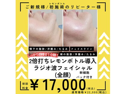 ボーテボナー(Beaute Bonheur)の写真