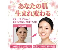 グラン ソレイユ(GRAN SOLEIL)