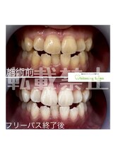 ホワイトニングサロン 札幌店/【ホワイトニング】#札幌#大通り