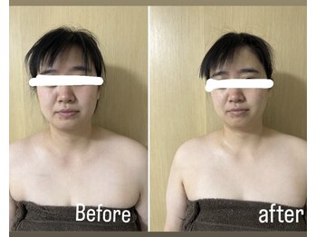 マオ(mao)/☆1回Before→after☆