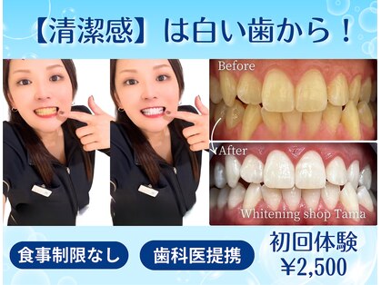 ホワイトニングショップ 多摩店の写真