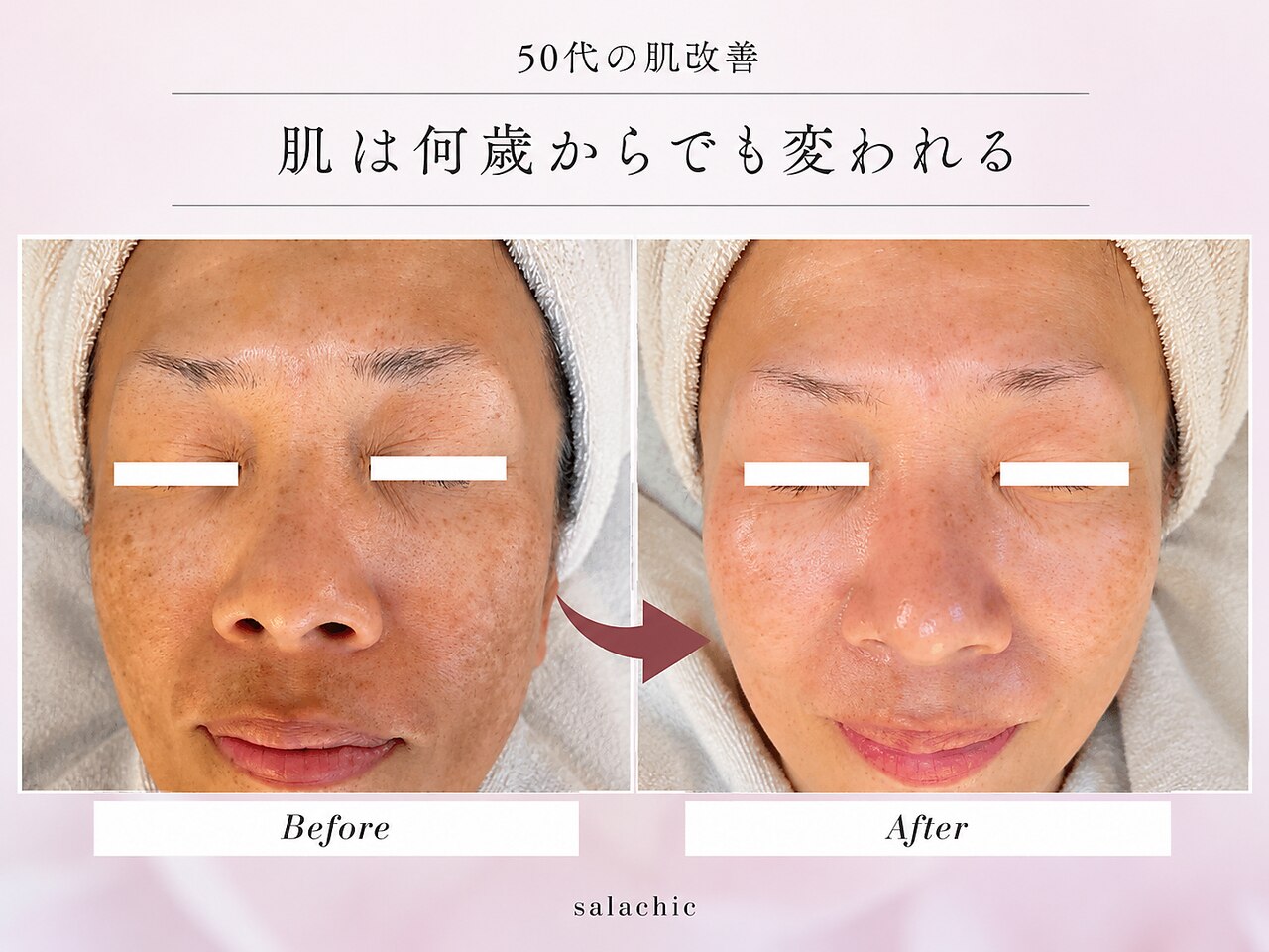 サラシック(salachic)｜ホットペッパービューティー