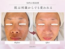 サラシック(salachic)