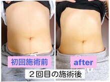コレカラ骨盤整体院/くびれ矯正