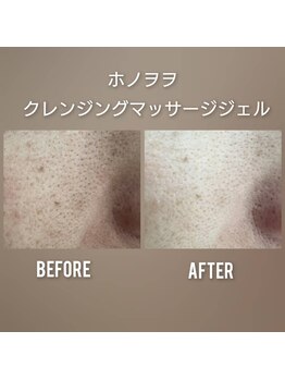 ルトゥール(Retour)/ふわふわモチモチ雪見肌