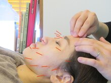 あいの心鍼灸整体院/美容鍼灸