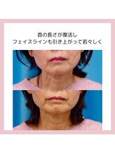 目元 口元のたるみ 眉間シワ改善専門サロン/姿勢が悪くて悩んでいる方向け