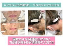 コネクトの雰囲気（回数セット、継続購入でエリアでもトップクラスなお手頃価格◎）