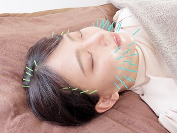 エモシオン トウキョウ(EMOTION TOKYO)/ほうれい線特化美容鍼