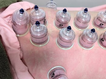 ひめ酵素ワーム(Warm)の写真/酵素風呂×カッピングの相乗効果で辛い冷えを解消!巡りを良くすることで全身ぽかぽかに♪本当の温活を実感!