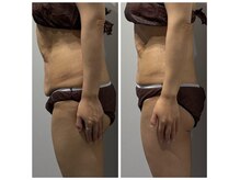 アーヒル(A”-HILU)の雰囲気（ジュラシック筋膜リリース/３回施術/痩身/ダイエット）