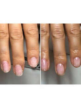 爪の悩みを解消できる（ケア含む）