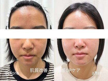 マイ フェア レディ(MY FAIR LADY)の写真