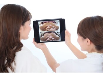 ロココ 錦糸町店(Rococo)/写真で比較しましょう