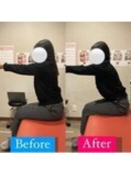 ナオル整体 宮崎院(NAORU整体)/20代女性施術事例【反り腰改善】