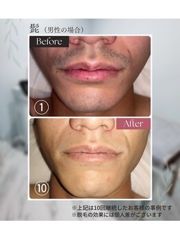TーROOM パーソナルトレーニング&ピラティスの写真/青ヒゲやカミソリ負けに悩む男性必見!少ない刺激で初めての方にも◎毎日のヒゲ剃りを楽にして清潔感UP!