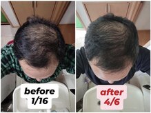 キノン(kinon)/３ヶ月で劇的変化！ヘアケア大事