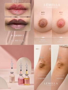 アムール(Amour)の写真/【LEMELLA正規導入店】デリケートゾーンの黒ずみ、唇のくすみを優しく整える♪韓国発祥の最先黒ずみケア