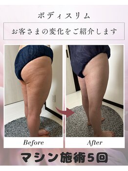 ボディスリムの写真/ヒップが上がる!太ももに隙間が!ひざ周りスッキリ!感動の声☆【Wマシン下半身徹底スリム120分】