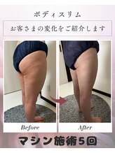ボディスリム