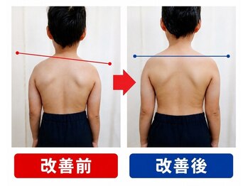 タオカ202(Taoka 202)/お子様の姿勢が気になる方