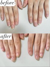 ニコワイズネイル(Nico Y's Nail)/【自爪育成コース】