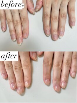 ニコワイズネイル(Nico Y's Nail)/【自爪育成コース】