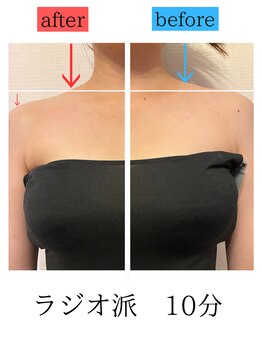 ユフラ(Juhla)/首肩集中デトックス