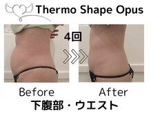 アネラ(ANELA)の雰囲気（ピンポイントで脂肪減少・皮膚の引き締めケアとともに代謝UP）