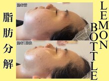 ヴィオール 名古屋栄店(VIOR)/＊人からも気づかれる変化＊