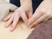 村の整骨院 鍼灸院