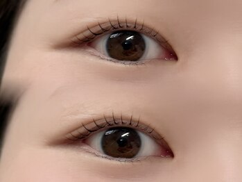 ジュベアイラッシュ 別府店(juve. eyelash)/UPforcelift