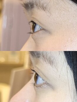 ダーム ド ローズ(Dame de rose)/【まぶたが上がるまつ毛パーマ】