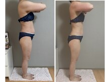 スズ(SUZU)の雰囲気（全身痩身）