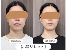 グラースア(grace a)の雰囲気（顔、頭、体の骨格と筋肉、お顔の表情筋//顎シャープで中顔面短縮）