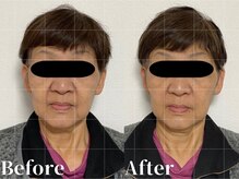 ウォーク(walk)/小顔キュール