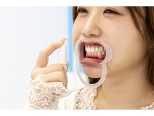 ホワイトニングカフェ 吉祥寺店(WhiteningCafe)/☆溶液を吹きかけます