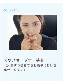 ホワイトニングショップ 新潟店/マウスオープナー装着