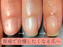 ネイルサロン ウナプラス(una+)の雰囲気（コンプレックス爪から見せたくなる爪へ♪自爪育成コースもご用意）