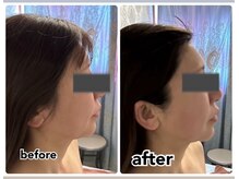 ミューズ よもぎ蒸し(MUSE)/◆インモード◆