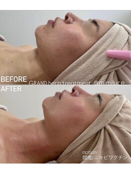 ミミルーチェ(mimiluce)/グランハーブ＋閻魔オプション