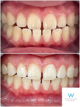 ホワイトニングショップ 奈良生駒店/元が明るい方も！