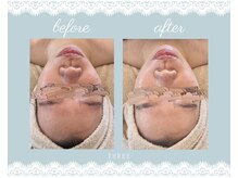 スリー(THREE)/クリスティーナのアンストレス♪