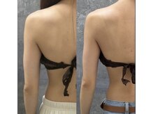 WINBACKで背中もスッキリ！