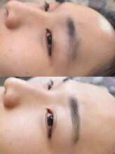 ニード 覚王山(NEED)/眉癖改善☆HBL