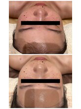 エイシスグロウ(asis glow.)/韓国肌管理